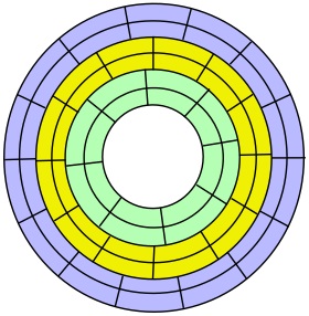 Platter with zones