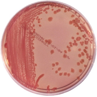 Petri dish