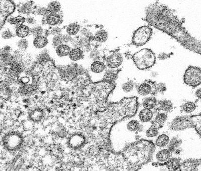 Coronavirus Photograph